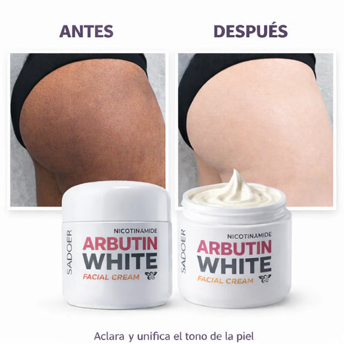 CREMA ACLARANTE ARBUTIN WHITE   — La Crema que Borra las Marcas que el Tiempo Dejó